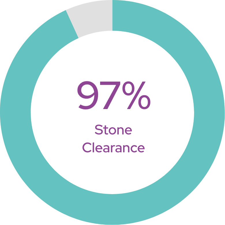 97 percent stone clearance with CVAC System